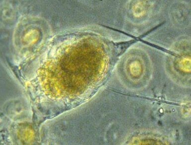 korm-dlya-ryb-keratella